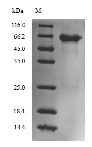 ALB / Serum Albumin Protein (Native)