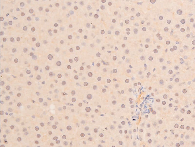 TP53 / p53 Antibody (phospho-Ser392)