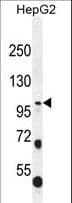 COL21A1 / Collagen XXI Antibody (aa204-232)