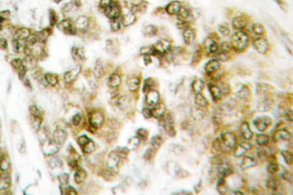 TBX15+18 Antibody (Asp164)