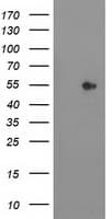 Monoclonal Mouse anti-Human SHPK / CARKL Antibody (clone OTI2A12, WB)