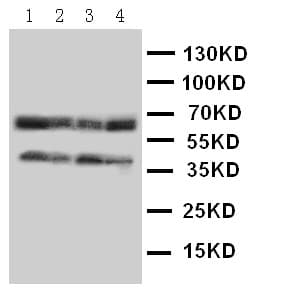 CCR5 Antibody (aa179-197)