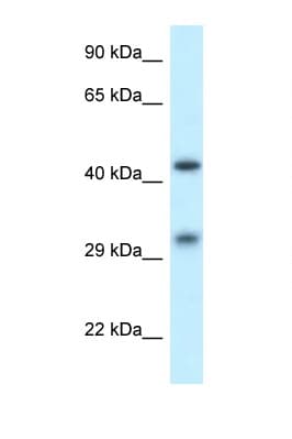 Polyclonal Rabbit anti-Human LIMPII / SCARB2 Antibody (aa25-74, IHC, WB)
