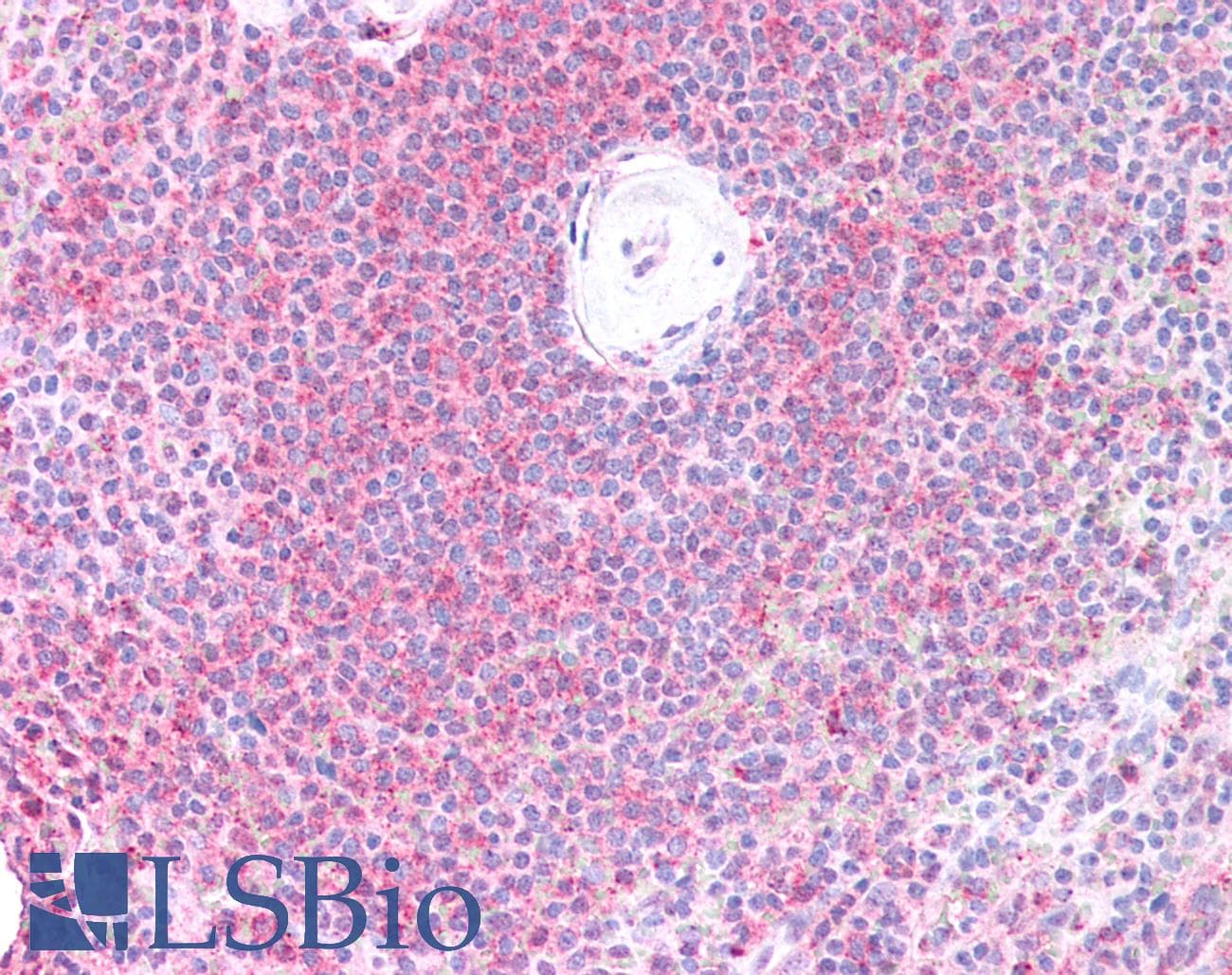 Polyclonal Rabbit anti-Human PTP1B Antibody (IHC, WB)