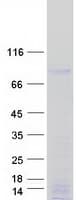 Human MEPCE Protein (Recombinant Myc-DDK (Flag))