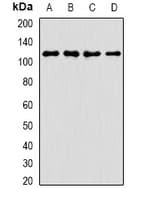 Polyclonal Rabbit anti-Human ANKRD52 Antibody (IHC, WB)