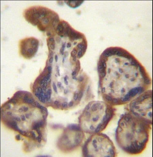 CGB / hCG Beta Antibody (aa137-165)