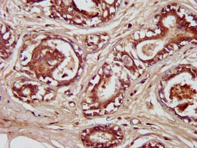 SDCCAG3 Antibody