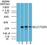 GPBAR1 / TGR5 Antibody