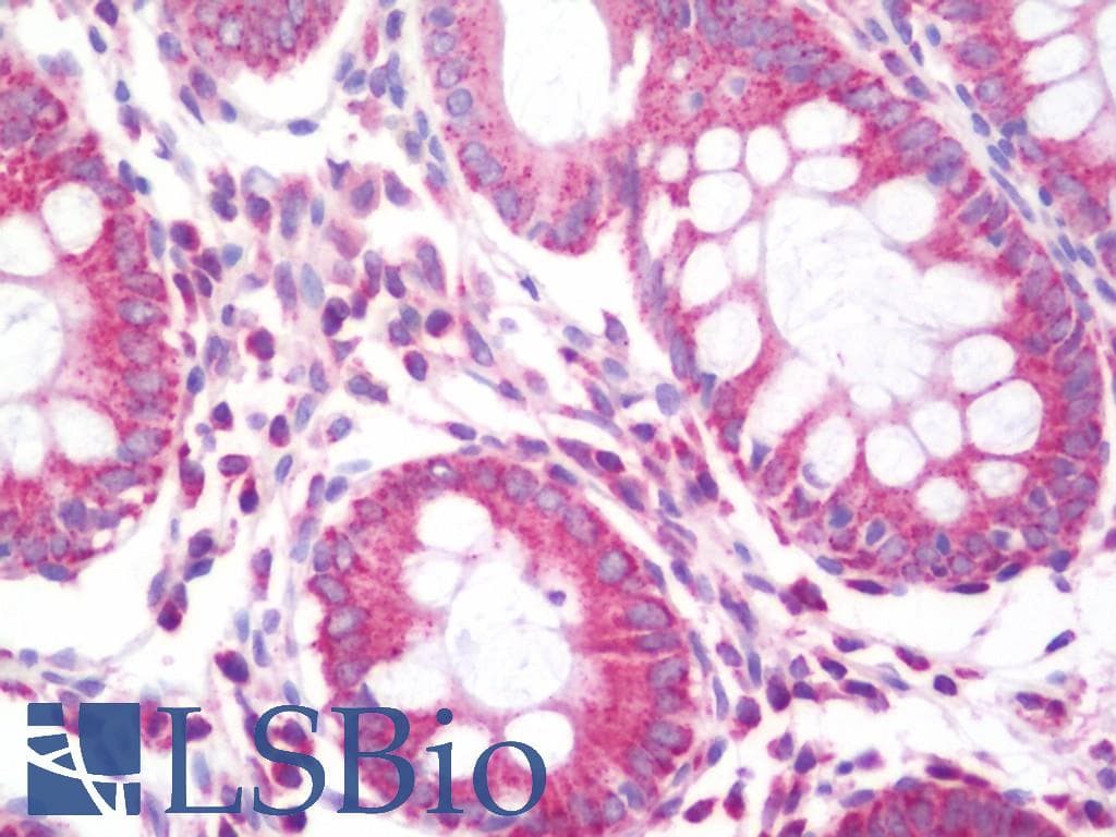 IHC-plus™ CAD Antibody (aa1650-1700)
