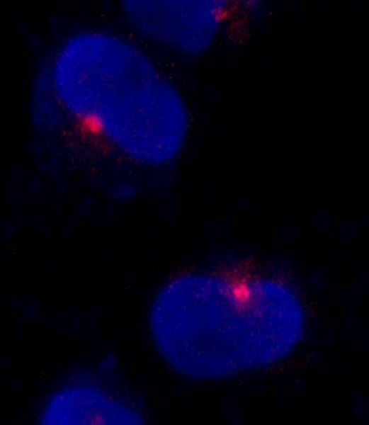 Polyclonal Rabbit anti-Human CEP290 Antibody (aa2429-2479, IF, WB)