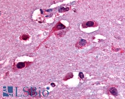 PathPlus™ OPRD1 / Delta Opioid Receptor Antibody (C-Terminus)