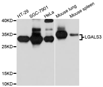 IHC-plus™ LGALS3 / Galectin 3 Antibody