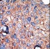 IKBKE / IKKI / IKKE Antibody (aa686-716)