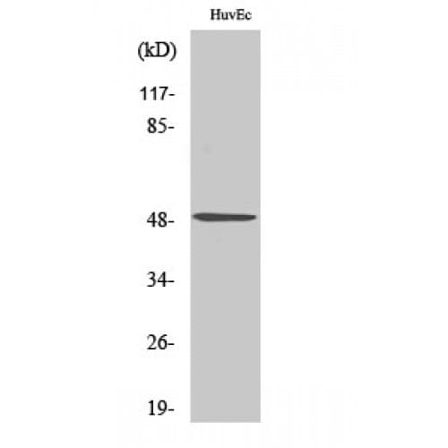 Polyclonal Rabbit anti-Human IP6K2 Antibody (130-210 aa, Internal, IHC, IF, WB)