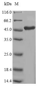 Human LSM4 Protein (Recombinant 6His-SUMO, N-terminus)