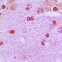 PAX2 Antibody (Internal)