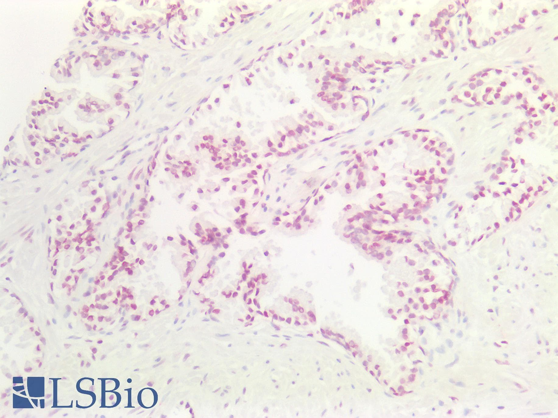 PathPlus™ CCND3 / Cyclin D3 Antibody (aa252-281)