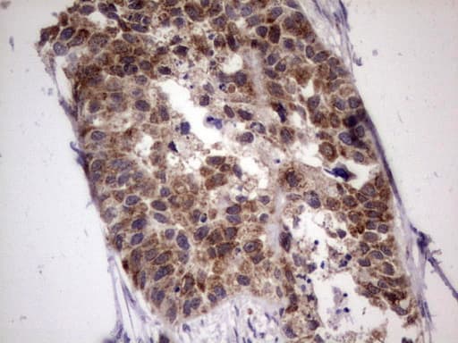 Monoclonal Mouse anti-Human ALDP / ABCD1 Antibody (clone OTI5G6, aa508-745, IHC, WB)