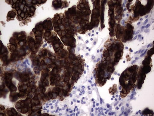 KRT19 / CK19 / Cytokeratin 19 Antibody (aa240-390, clone OTI7H7)
