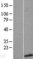 SMR3B Protein (Over-Expression Lysate Myc-DDK (Flag))