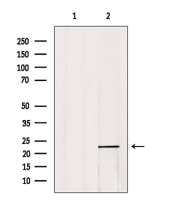 CBFB Antibody