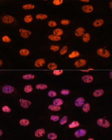 Polyclonal Rabbit anti-Human MYEF2 Antibody (IF)