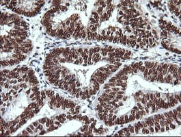 THUMPD1 Antibody (clone OTI1H6)