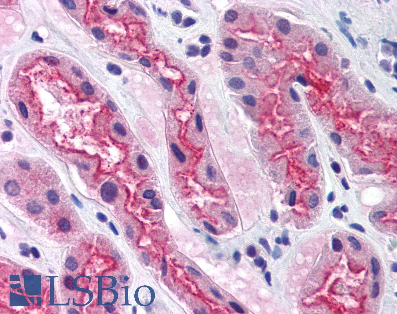 IHC-plus™ Polyclonal Rabbit anti-Human PDZK1 Antibody (C-Terminus, IHC, IF, WB)