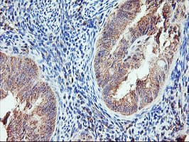 AGPAT5 Antibody (clone OTI1D4)