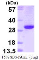 Human EFNB1 / Ephrin B1 Protein (Recombinant His)