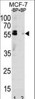 Polyclonal Rabbit anti-Human SQSTM1 Antibody (aa317-346, IHC, IF, WB)