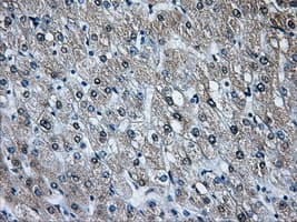 HDAC10 Antibody (clone OTI3C2)