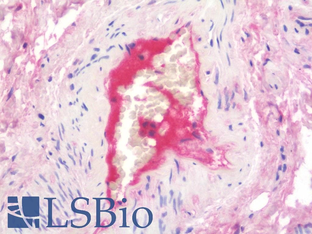 IHC-plus™ Complement C1s Antibody (clone 2A8)