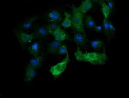 ANAPC11 / APC11 Antibody (clone OTI1B11)