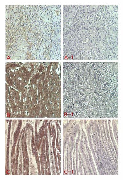 Polyclonal Rabbit anti-Human FGF21 Antibody (IHC, WB)