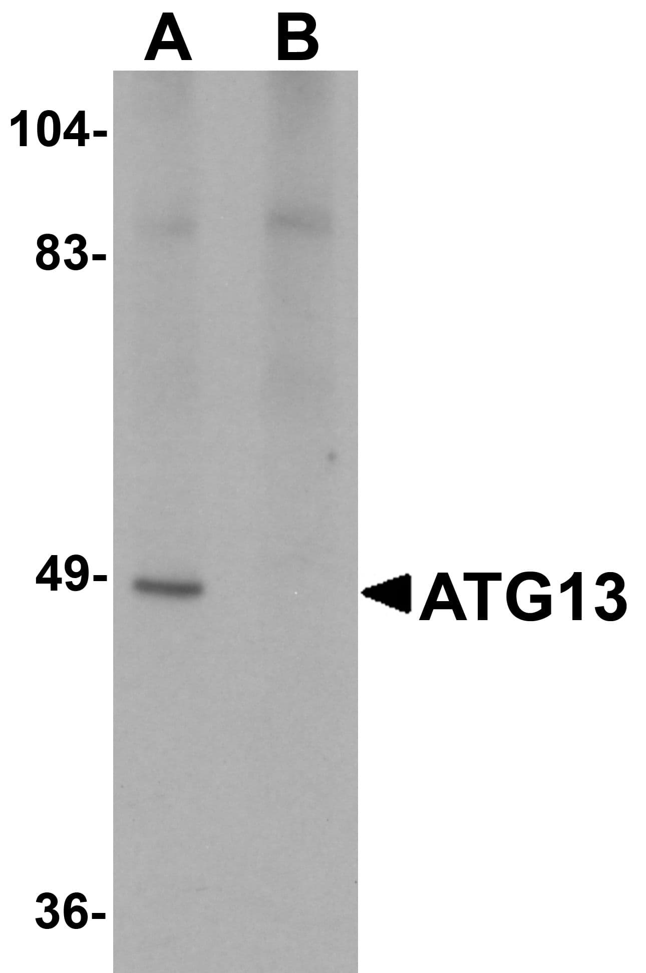 IHC-plus™ KIAA0652 / ATG13 Antibody