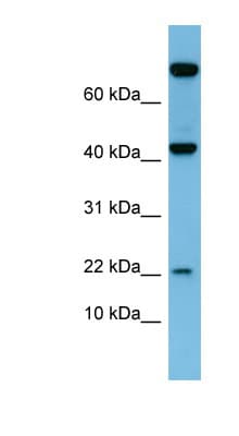 Polyclonal Rabbit anti-Human Leptin Antibody (N-Terminus, IHC, WB)