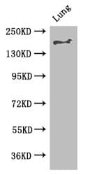 Polyclonal Rabbit anti-Human Tuberin / TSC2 Antibody (IF, WB)