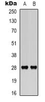 BCL2 / Bcl-2 Antibody (phospho-Ser70)