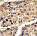 IGFALS / ALS Antibody (aa308-335)