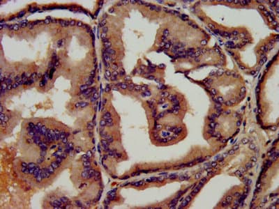 LF / LTF / Lactoferrin Antibody