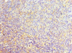 SRSF4 / SFRS4 Antibody (aa1-180)