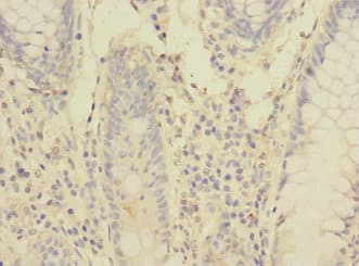 PCDH1 / PCD1 Antibody