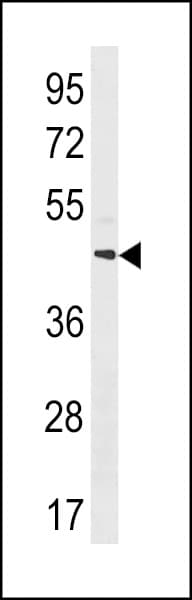 MRGPRX4 / MRGX4 Antibody (aa278-304)