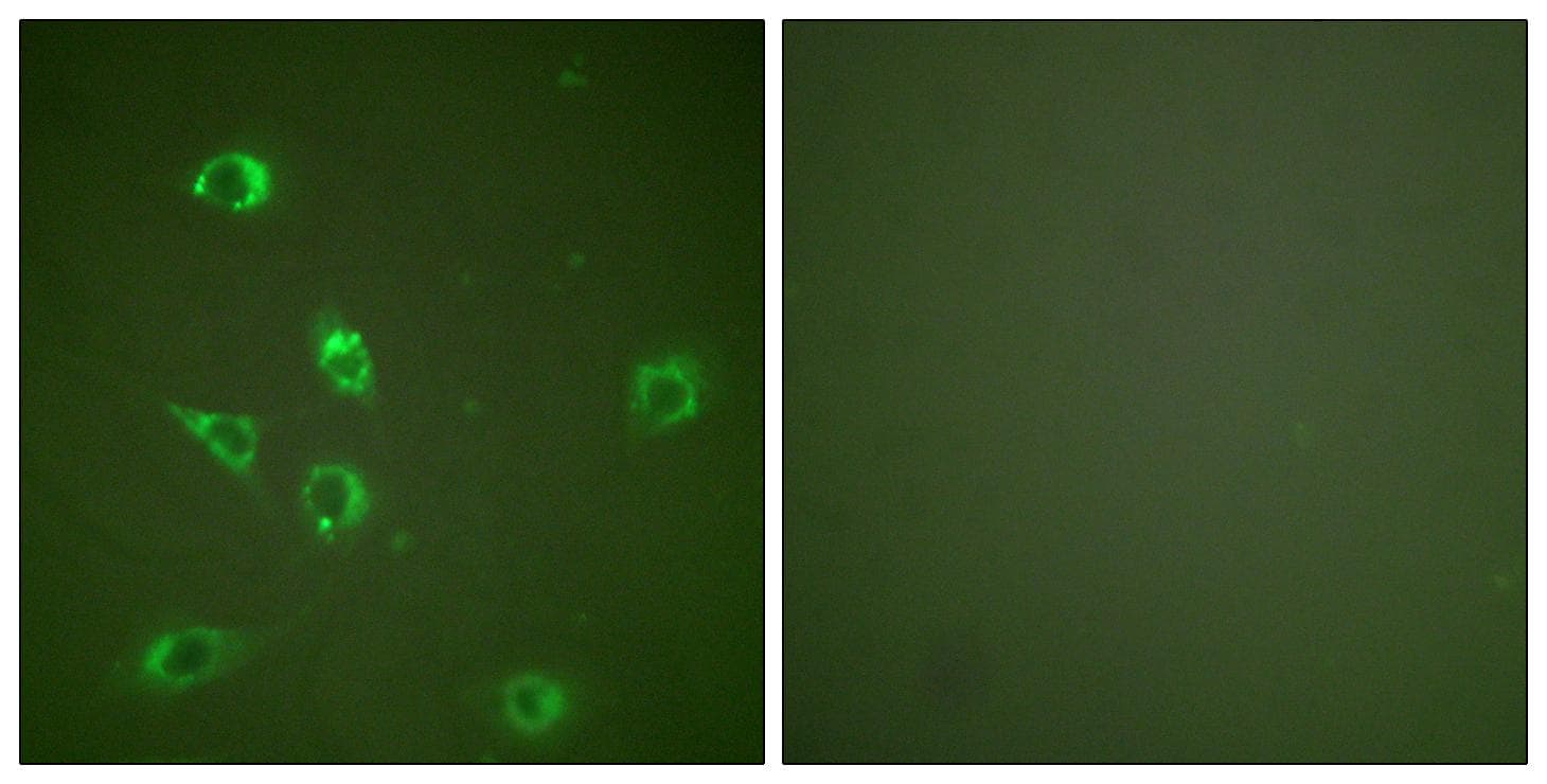 GCG / Glucagon Antibody