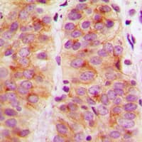 Polyclonal Rabbit anti-Human FAK / Focal Adhesion Kinase Antibody (Internal, IHC, IF, WB)