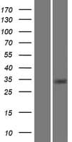 Human CA8 / Carbonic Anhydrase VIII Protein (Over-Expression Lysate Myc-DDK (Flag))