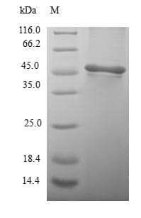 Human PSPH Protein (Recombinant GST, N-terminus)