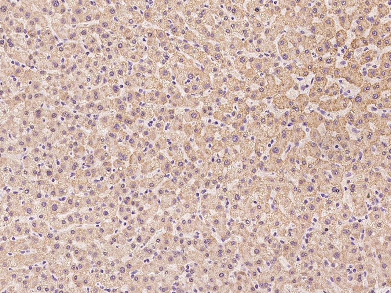 TDO2 Antibody